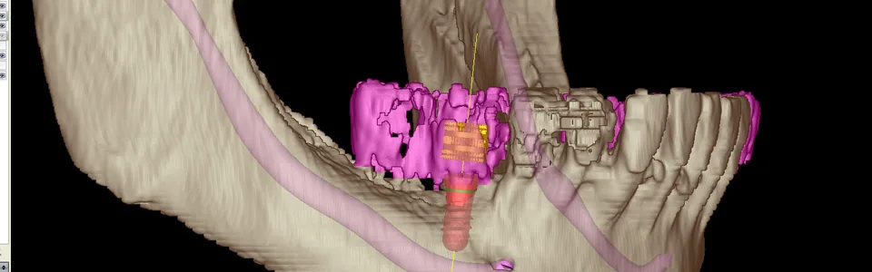 Pr&auml;zise Diagnostik und Behandlungsplanung dank 3D-Technologie