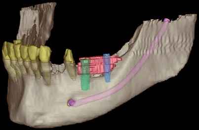 3-dimensionale Diagnostik erh&ouml;ht die Planungssicherheit