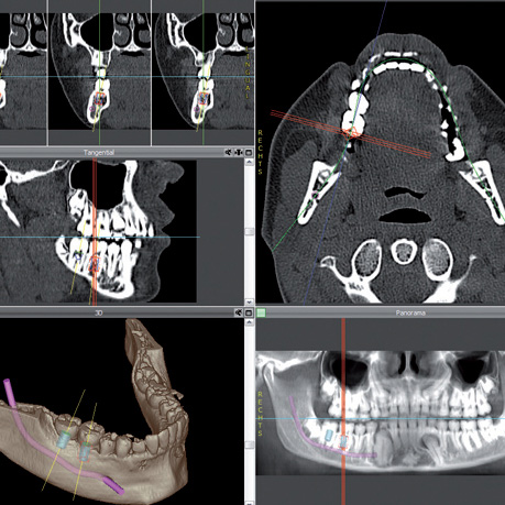 Zahnarzt Hildesheim Kleinste Details exakt visualisieren und analysieren