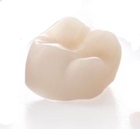 Zahnarzt Hildesheim sorgt mit Vollkeramik für Zähne, die aussehen wie natürliche.